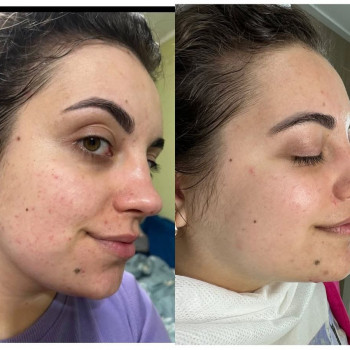 Ирина Бурая, Львов Фото - 5