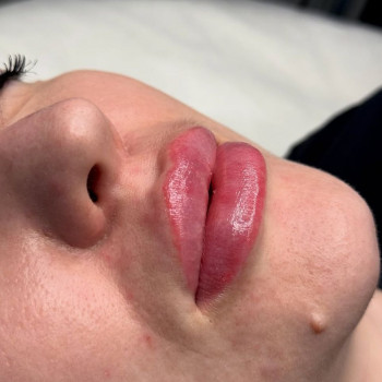 Ольга Малиш, Львів Фото - 5