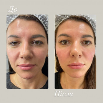 Світлана Дреботій, Львів Фото - 5