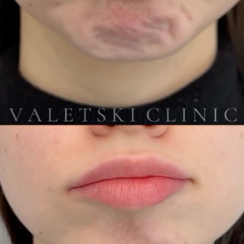 Valetski Clinik, Луцк Фото - 5