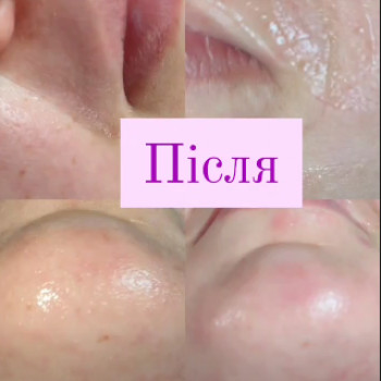 Любовь Бегун, Луцк Фото - 5