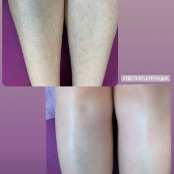 Людмила Панасюк, Луцьк Фото - 6