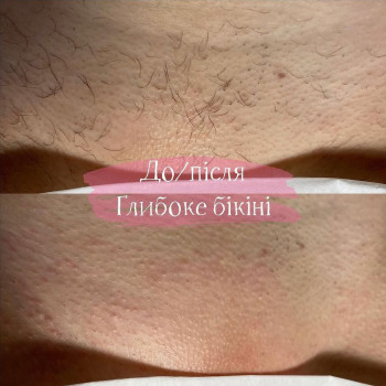 Анна Кнар, Львов Фото - 5