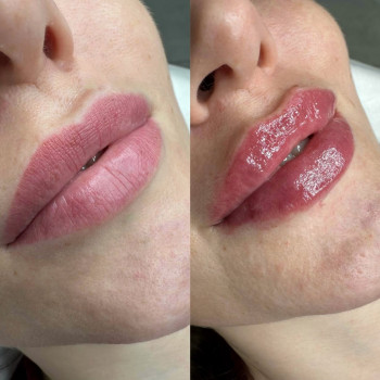 Наталья Фоменко, Київ Фото - 5