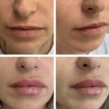 Наталья Фоменко, Київ Фото - 7