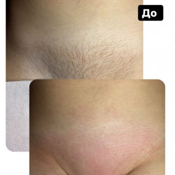 Романна Луців, Львів Фото - 5