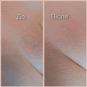 Алла Палій, Львів Фото - 5