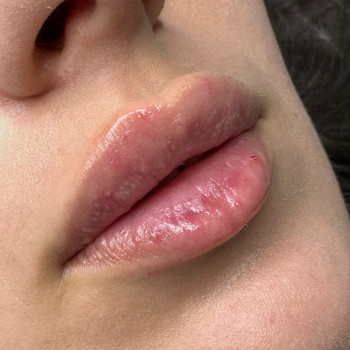 Натуральні губи