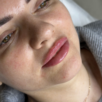 Натуральне збільшення губ