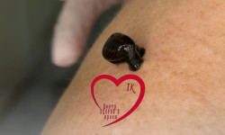 Гірудотерапія Салон красоты Імперія краси Кременчуг