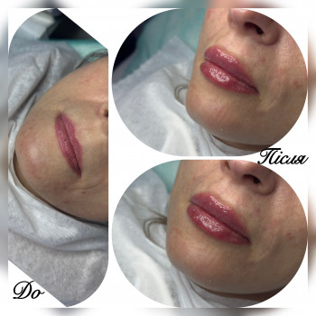 Валентина Коваль, Ладыжин Фото - 5