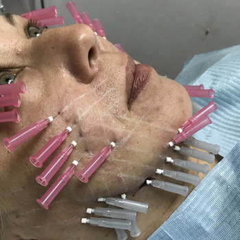 Наталя Мінєєва, Дніпро Фото - 7