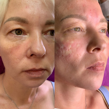 Наталя Мінєєва, Дніпро Фото - 8