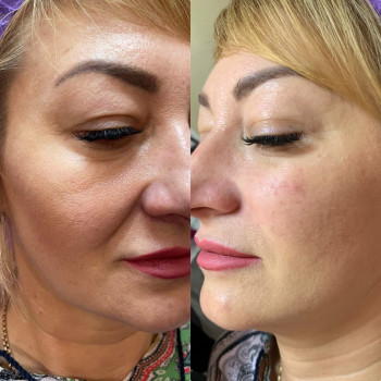 Наталя Мінєєва, Дніпро Фото - 9