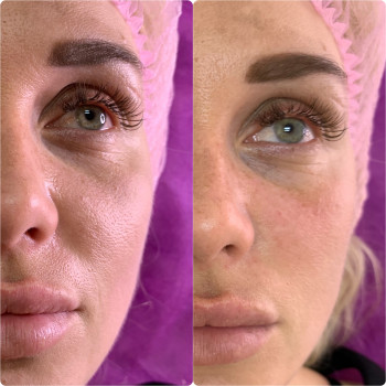 Наталя Мінєєва, Дніпро Фото - 13