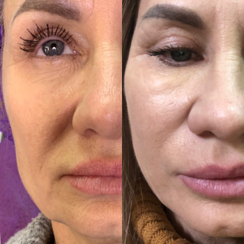 Наталя Мінєєва, Дніпро Фото - 16