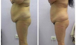 Обгортання Косметолог Оля Белая Церковь