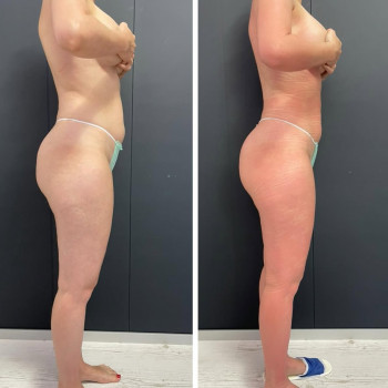 Обгортання Leyla Mazaku
                    Косметолог Оля Біла Церква