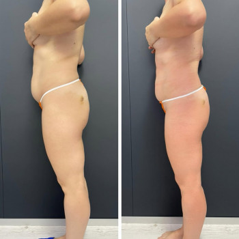 Обгортання Leyla Mazaku
                    Косметолог Оля Біла Церква