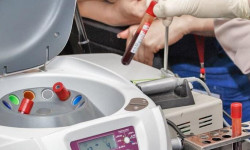 плазмолифтинг Стоматологічна клініка Пальміра Дент Полтава