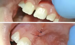  Стоматологічна клініка Пальміра Дент Полтава