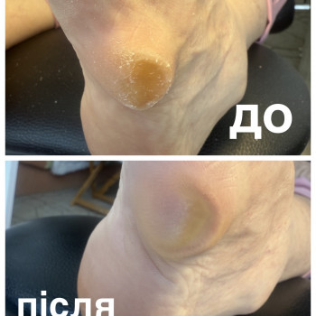 Надія Сташкевич, Українка Фото - 14