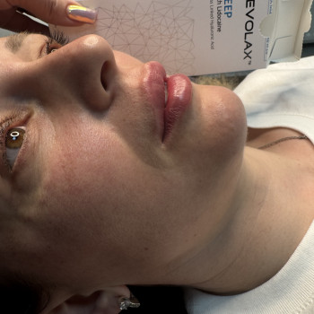 Lady Beauty, Коростень Фото - 5