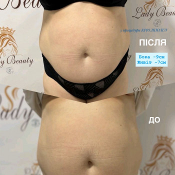 Lady Beauty, Коростень Фото - 17