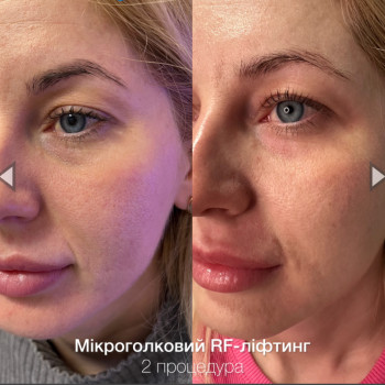 Lady Beauty, Коростень Фото - 20