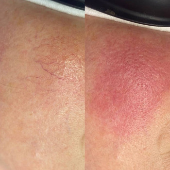 Lady Beauty, Коростень Фото - 24