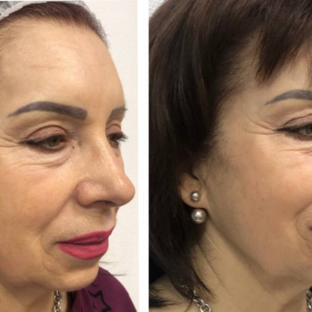 Lady Beauty, Коростень Фото - 25