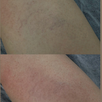 Lady Beauty, Коростень Фото - 26