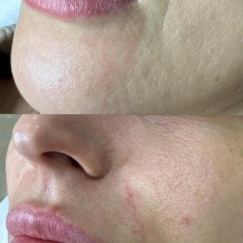 Інна Ганенко, Івано-Франківськ Фото - 5