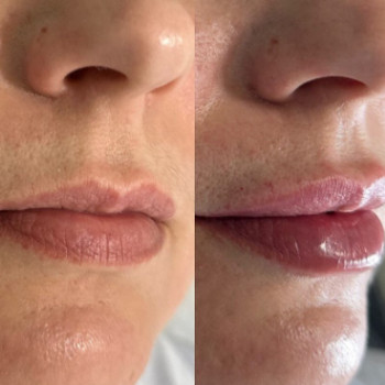 Інна Ганенко, Івано-Франківськ Фото - 7