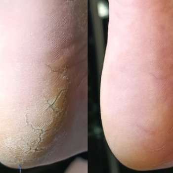 Оксана Кухар, Ивано-Франковск Фото - 6