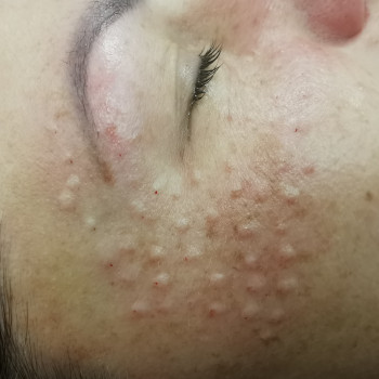 Наталья Анжуйская, Запоріжжя Фото - 16