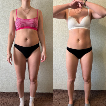 Антицеллюлитный масаж
                    Массажист Филипп Днепр