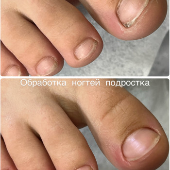 Педикюр
                    Мастер маникюра Наталья Кременчуг