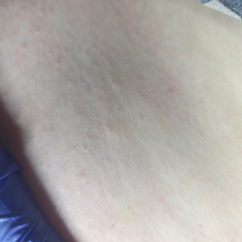 Лідія Руденко, Бершадь Фото - 5