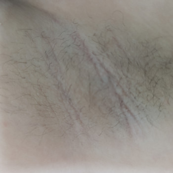 Лідія Руденко, Бершадь Фото - 6