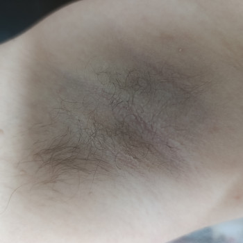 Лідія Руденко, Бершадь Фото - 7