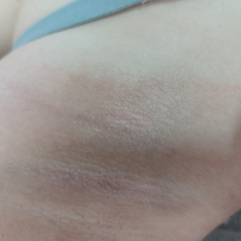 Лідія Руденко, Бершадь Фото - 8