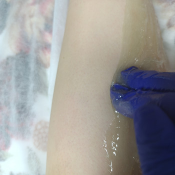 Лідія Руденко, Бершадь Фото - 9