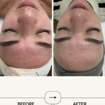 Віталіна Шалімова, Житомир Фото - 5