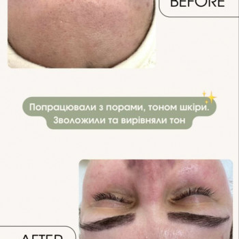 Віталіна Шалімова, Житомир Фото - 6