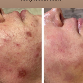 Вікторія Бобко, Киев Фото - 6