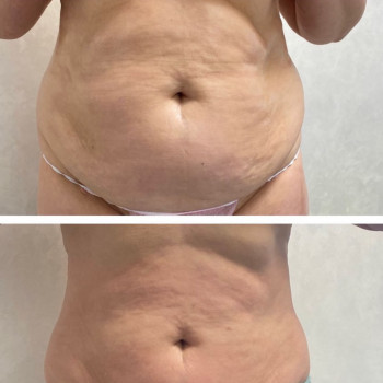 Вікторія Бобко, Киев Фото - 7