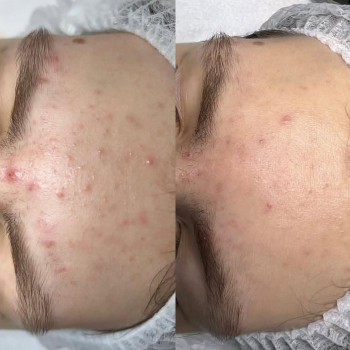 Ольга Малиновская, Житомир Фото - 5