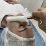 Кріомасаж лиця,  голови , знижка 20 % Майстер з пірсингу Татьяна Київ