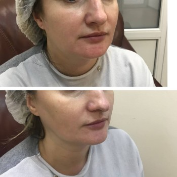 Нелли
